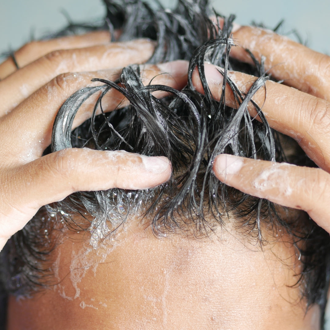 ketoconazole shampoo